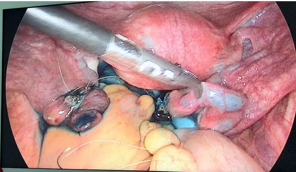 微信圖片_20220324104951.png 圖片